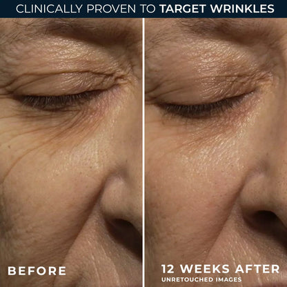 Celimax The Vita-A Retinal Shot Tightening Booster